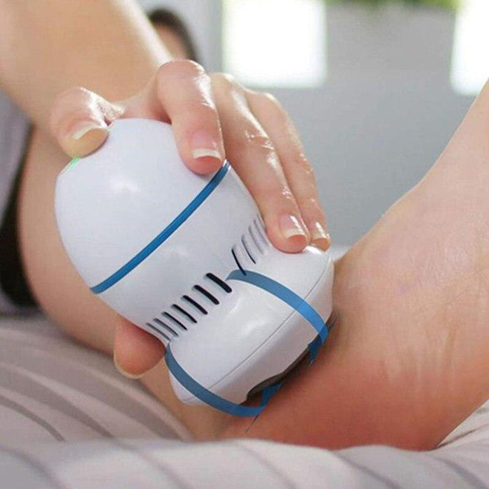 Electric Foot Callus Remover With Built-In Vacuum